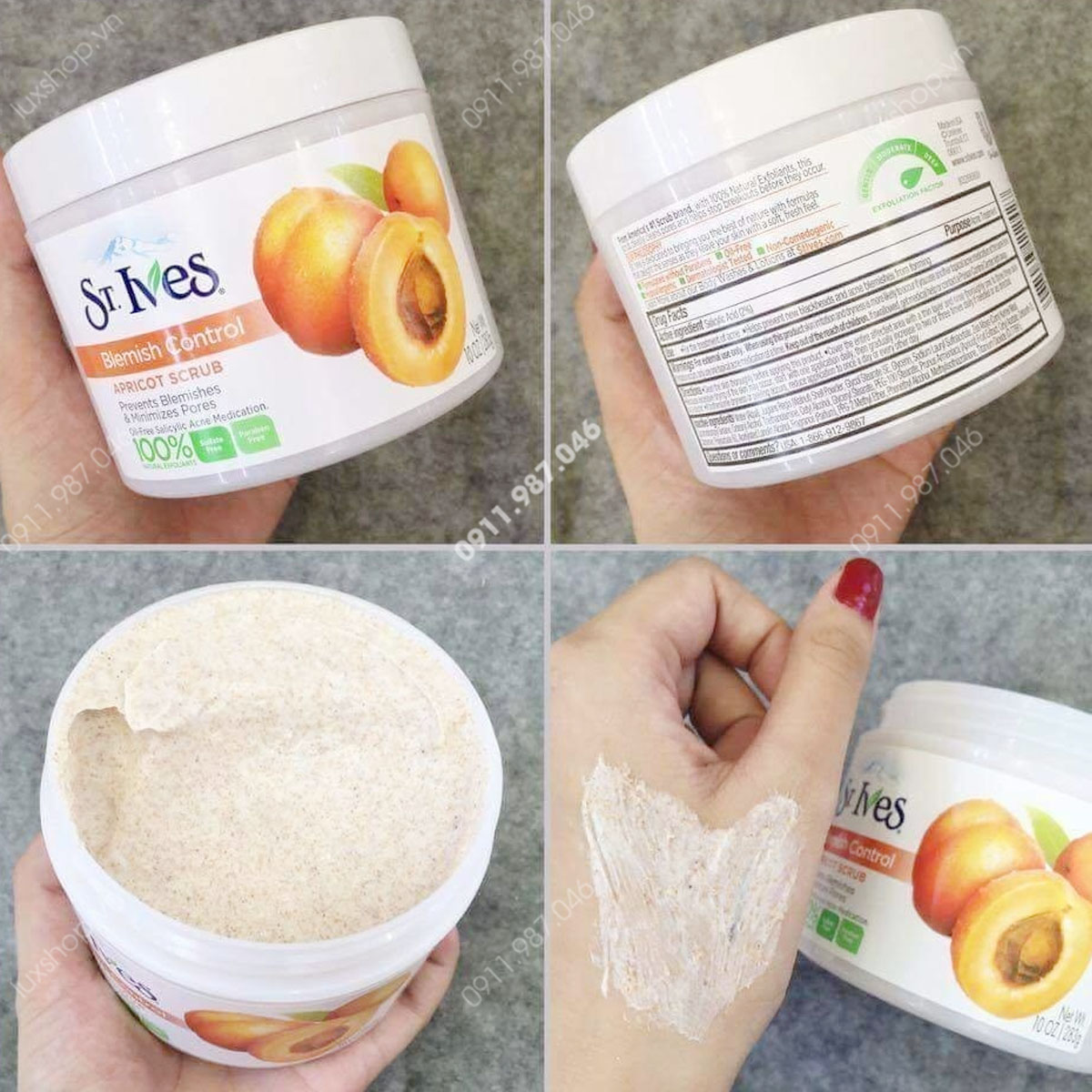 Kem tẩy tế bào chết St.Ives Blemish Control Apricot Acrub & St.Ives Fresh Skin Apricot Scrub 283g chính hãng (Mỹ) - PN60423